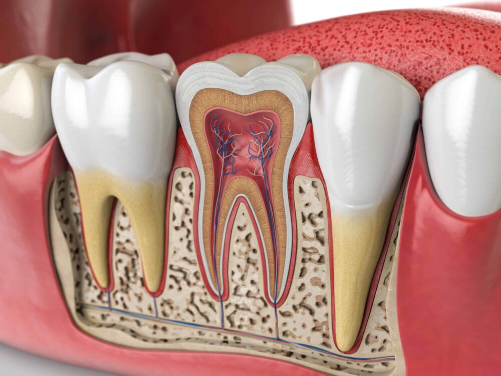 root canals Purcellville