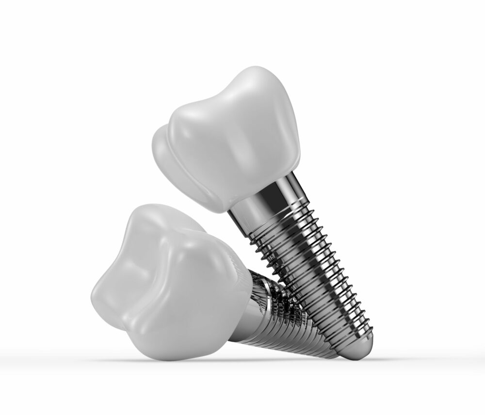 dental implants Purcellville